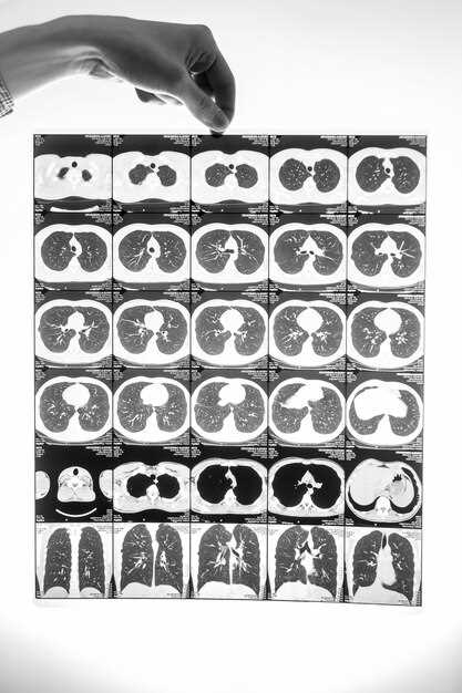 Delayed Images at 24 h: Hidden Billing Code 78710-TC That Doubles Reimbursement Without Extra Contrast