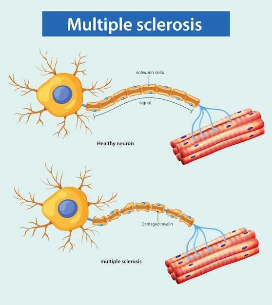 Neurontin Lyrica comparison dosage side effects cost for nerve pain 2024
