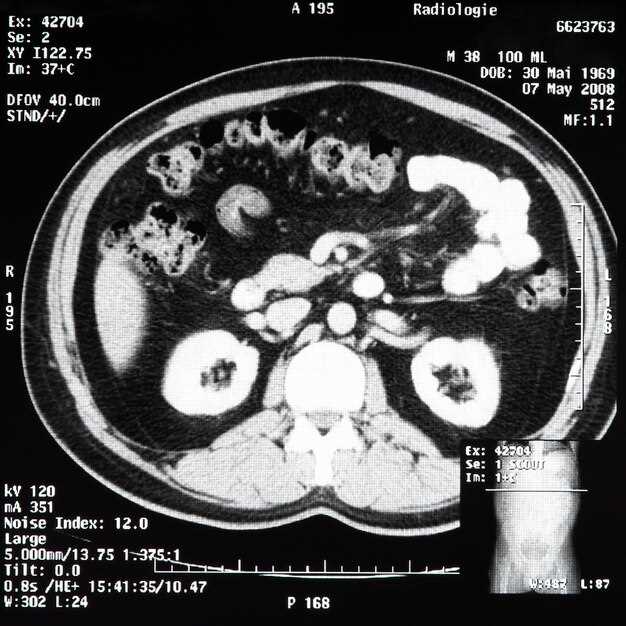 4. Ask for the “physiologic bladder” protocol