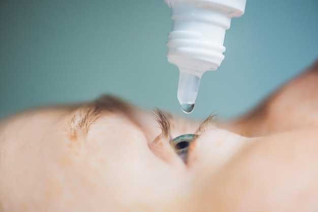 Contact-lens wearers: which lens type survives the steroid, and how long to wait before re-insertion