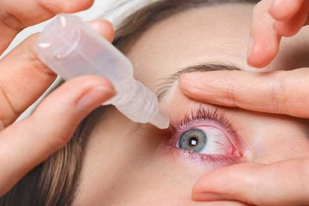 Prednisolone Eye Drops: 7 Insider Hacks to Calm Red Eyes & Sell Out Your Pharmacy Shelf