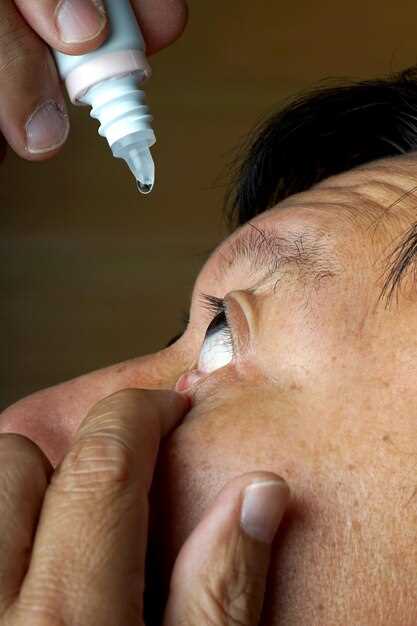 The 4-step “Eye-Lash Game”